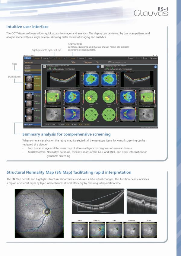 RS-1 Glauvas – OCT NIDEK_page-0007