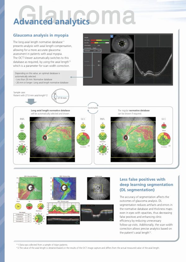 RS-1 Glauvas – OCT NIDEK_page-0008