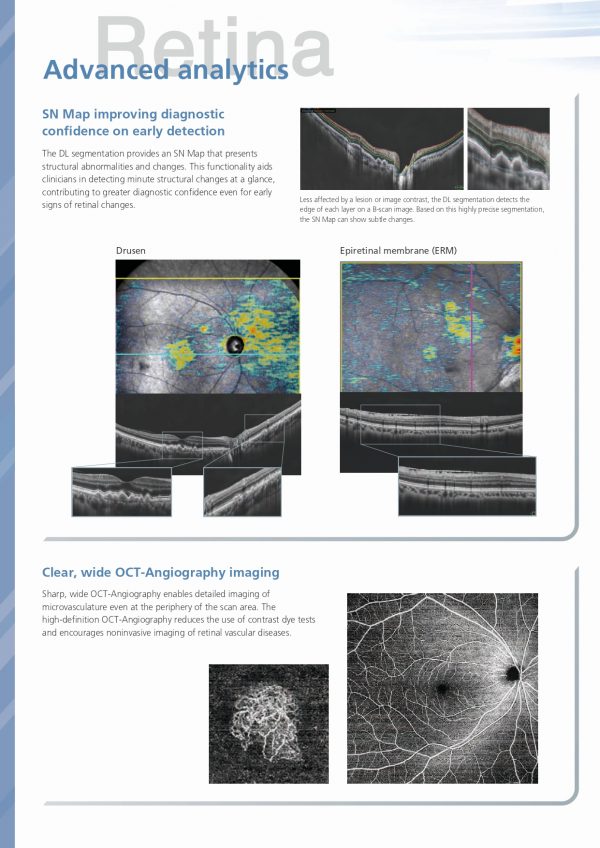 RS-1 Glauvas – OCT NIDEK_page-0010