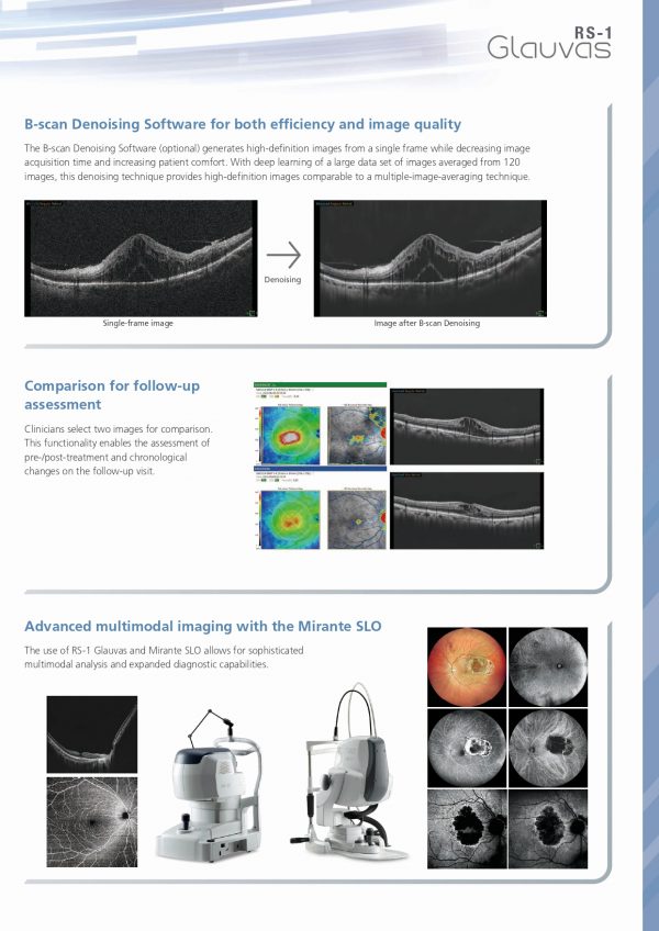 RS-1 Glauvas – OCT NIDEK_page-0011