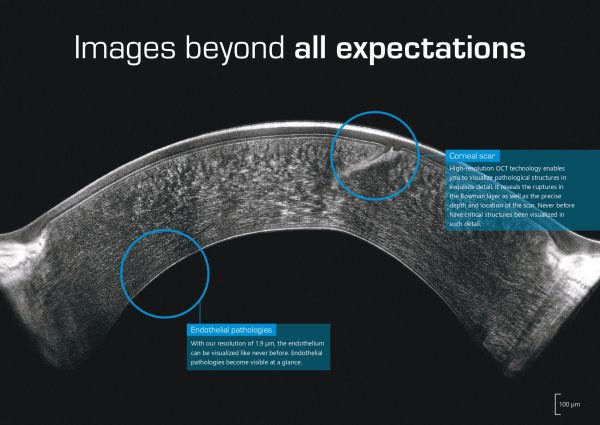 Pentacam® Cornea OCT – Tomógrafo + AS-OCT OCULUS_page-0002