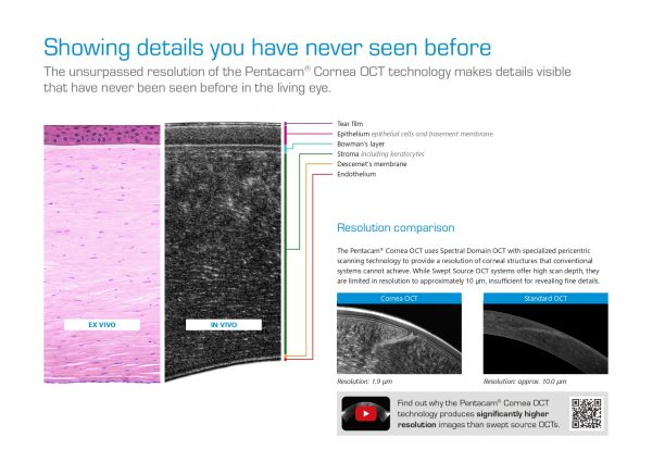 Pentacam® Cornea OCT – Tomógrafo + AS-OCT OCULUS_page-0003